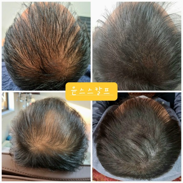 [서울/관악구] 윤스스칼프