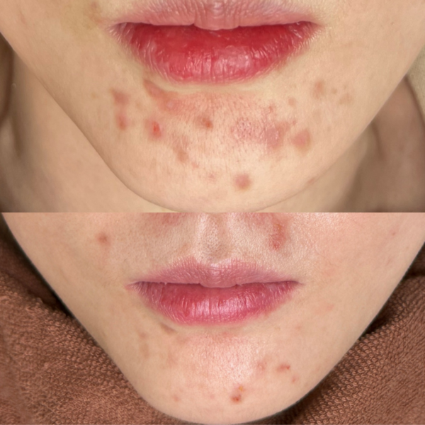 [강원 원주] 리하이에스테틱