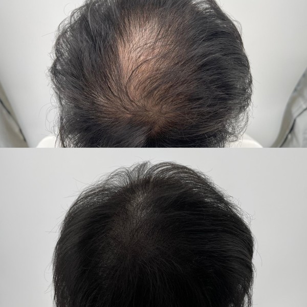 [대전 서구] 옐로도트 (yellowdot)