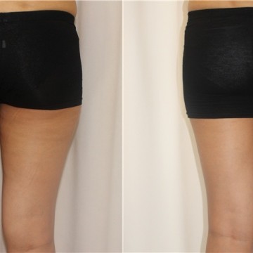 [서울 마포] 쁘띠슬림