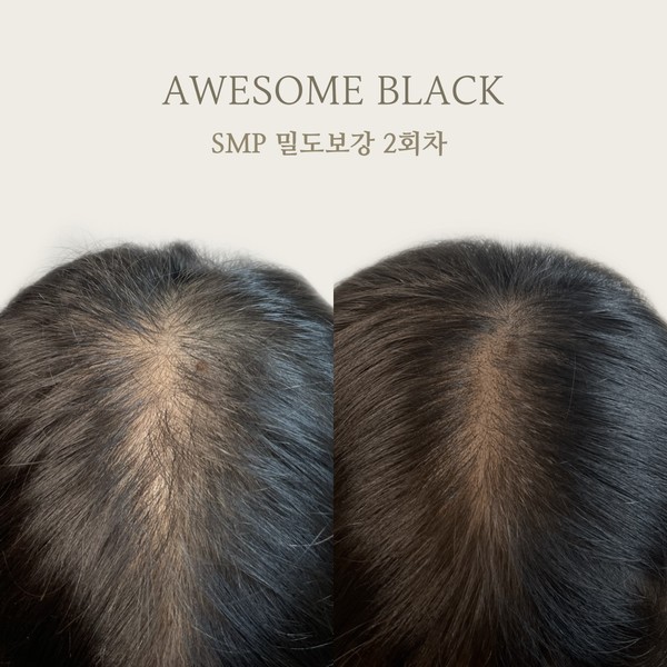 [광주] 어썸블랙