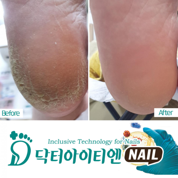 [경기 안산] 보라공주