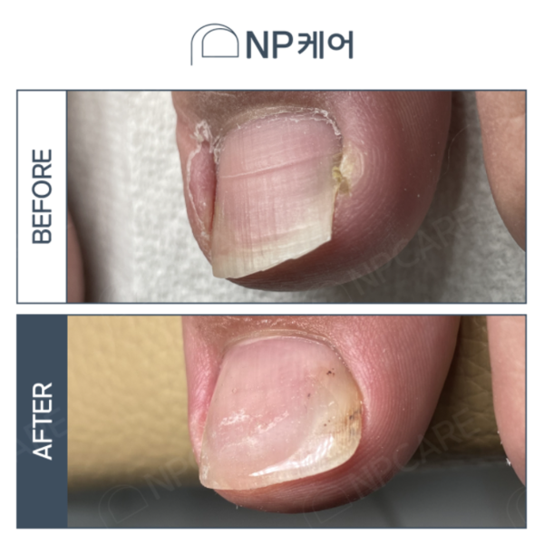 엔피케어 대전서구점