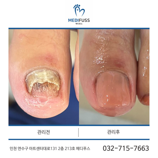 [인천 연수구] 메디푸스