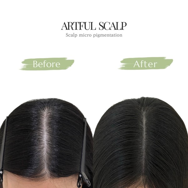 [부산 해운대] 아트풀스칼프 (artful scalp)