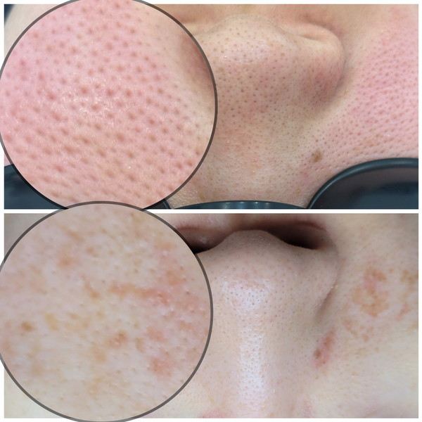 [경북 경산] 샤인에스테틱