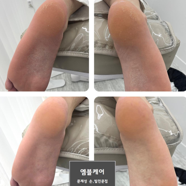 [울산] 엠블케어